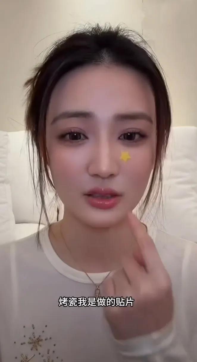 演员徐璐透露自己上牙做了牙贴片！近日，演员徐璐在直播中大方回应了“上下牙色差”