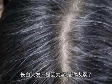 3～7天白发就能变黑？这是真的吗？刷到一个热搜，真的太让人意外了。有