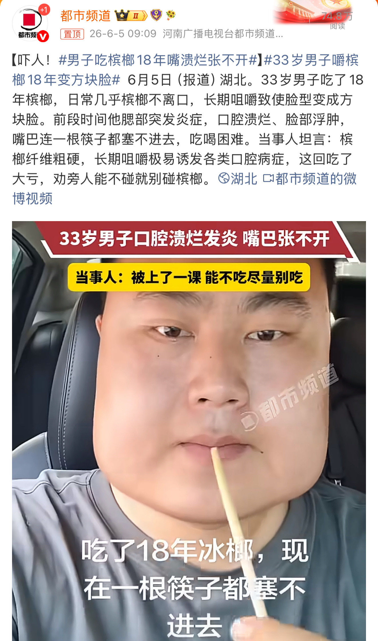 男子吃槟榔18年嘴溃烂张不开这种新闻每年都有。没用。已经上瘾的人不会看。看了也不