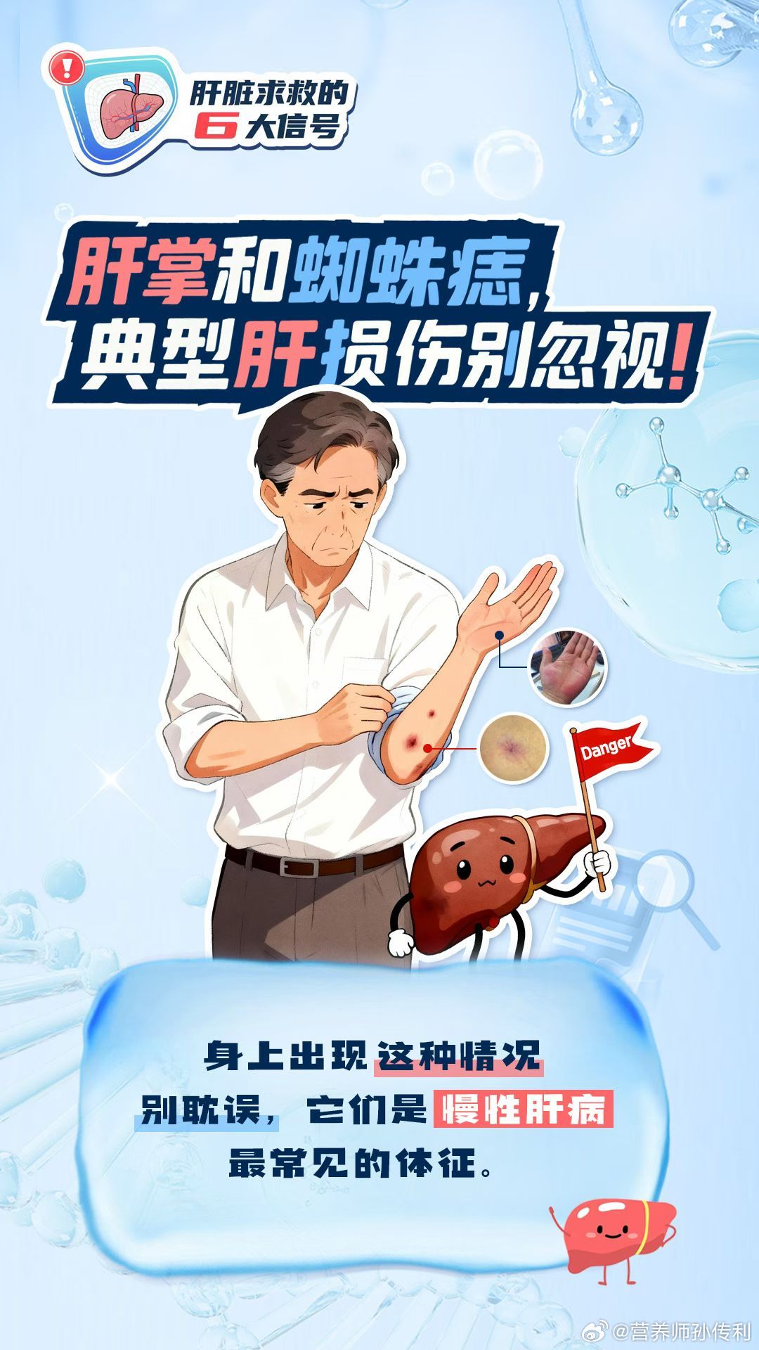 男性健康必修课全民营养提升计划健闻登顶计划这6个“小毛病”，可能是你的肝脏在求救