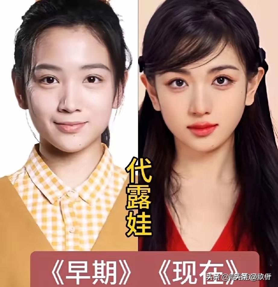 6位当红小花早期vs现在颜值对比，有人“换脸”成功，有人只是瘦了虞书欣是从“