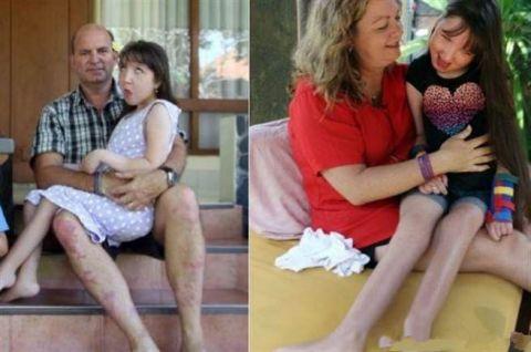 父母切除自己女儿的子宫, 并称是为了保护她
