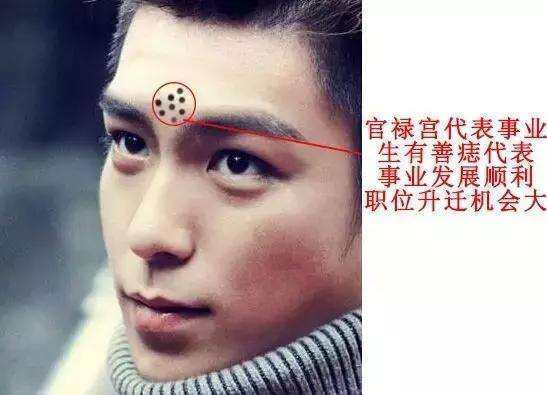 君子爱财取之有道, 人身上这9处善痣代表生财有道!