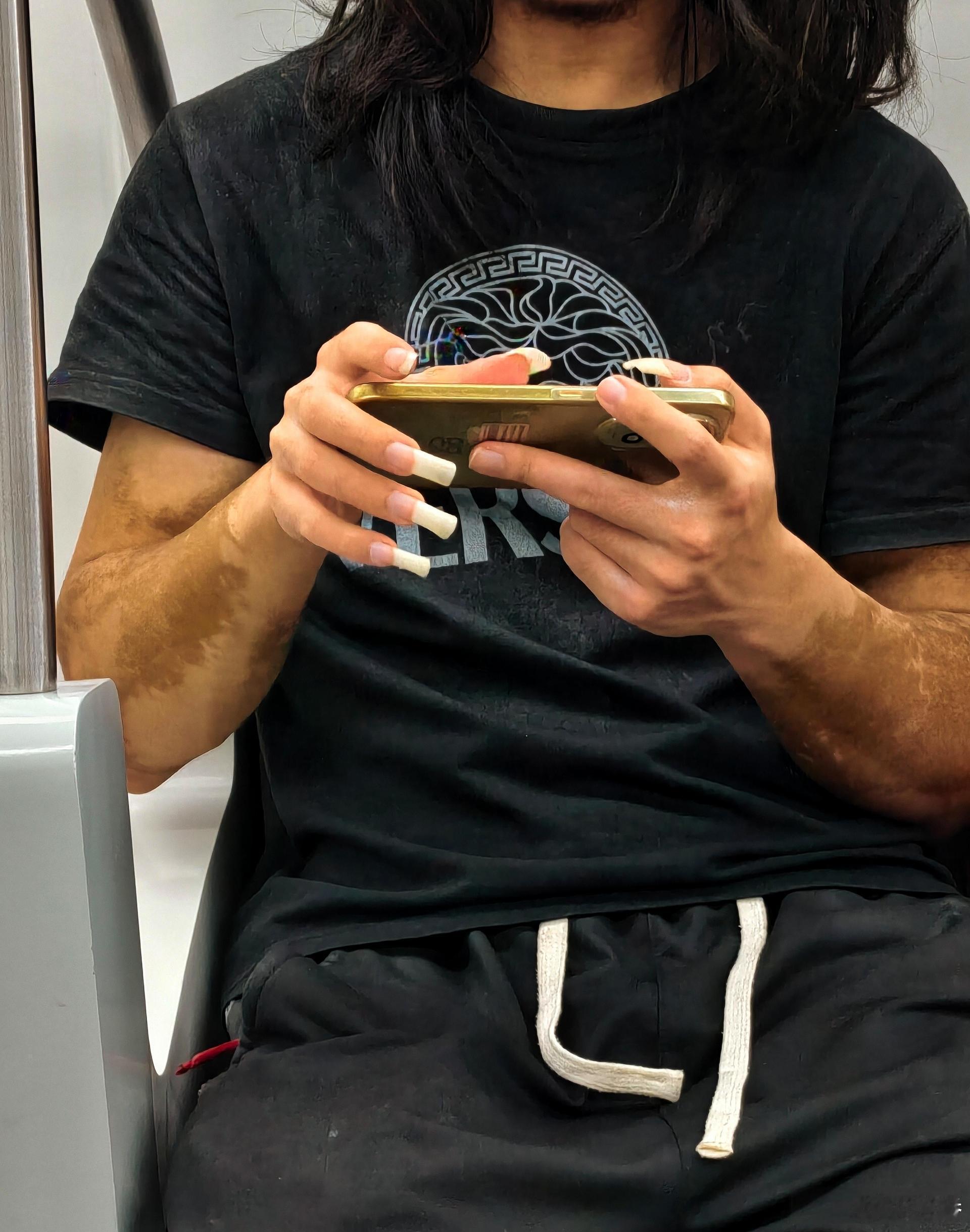 如何评价这种？是有什么心理疾病，还是行为艺术吗，怎么敢出门的？​​​