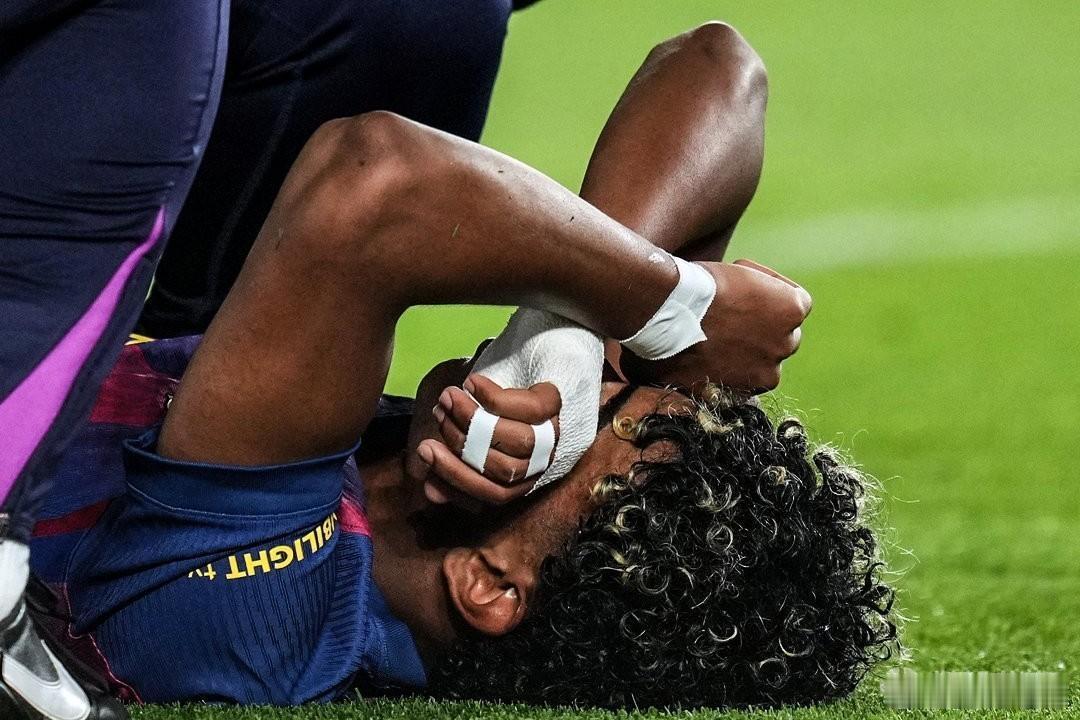 亚马尔亚马尔右脚踝受伤将缺战3至4周马卡：亚马尔将缺席西班牙国家德比，甚至可能