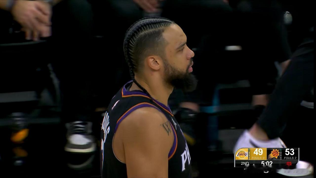 湖人大将范德比尔特真是太杀人诛心了！在今天湖人客场以116：114击败太阳的赛后