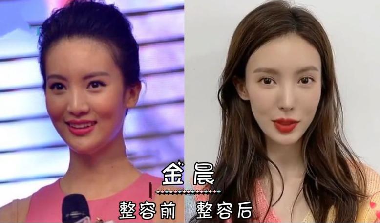 为了追求美丽，很多女明星不惜打针上千次，搞得自己的亲妈都认不出，还有因此丧命的。