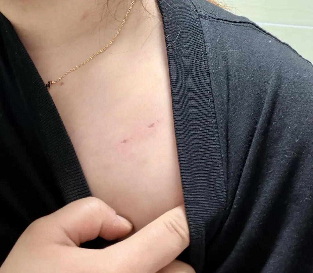云南昭通，一个女的自己在家。她刚把衣服脱了准备洗澡，就听见卫生间外头有脚步声，当