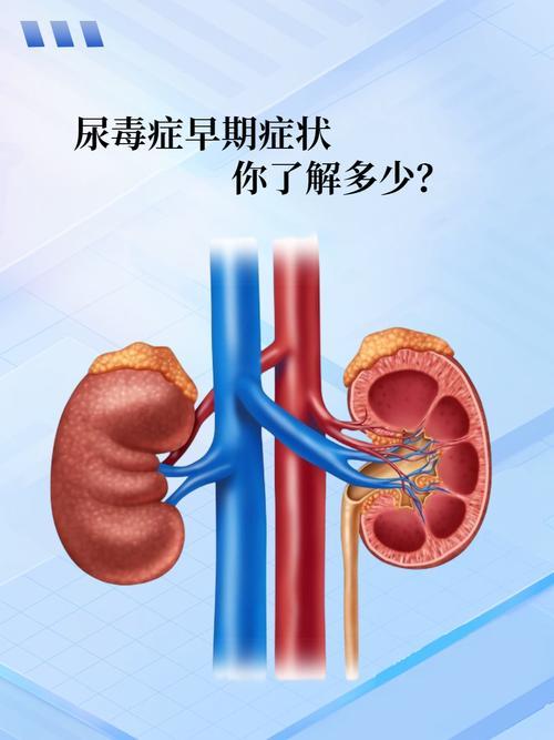 男子感冒输液后确诊尿毒症！小时候吃的“神药”安乃近，竟是家畜禽通用兽药？看完一身