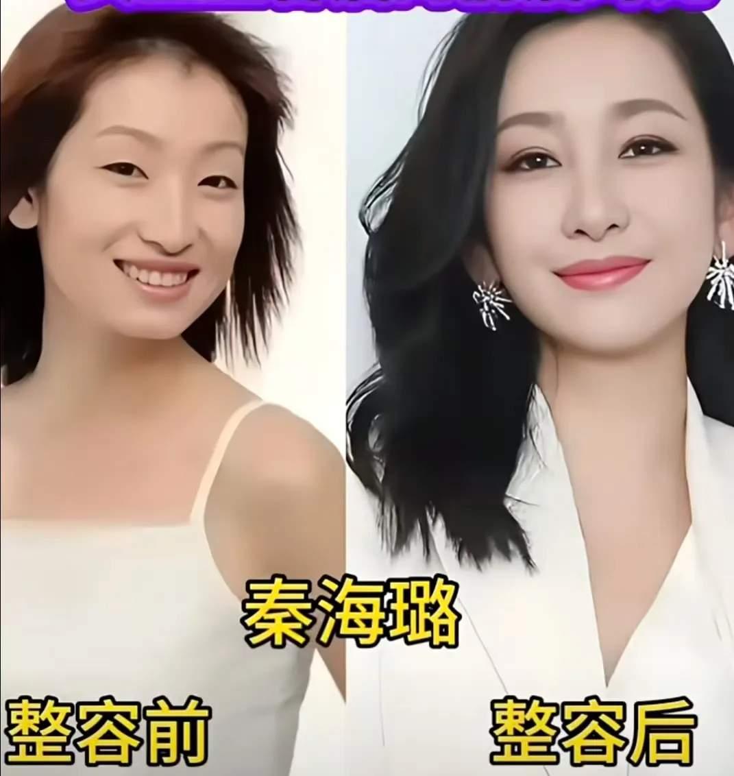 谢楠、秦海璐等六位女星今昔对比反差拉满，青涩旧照对比精致现貌，不少人靠医美改头换