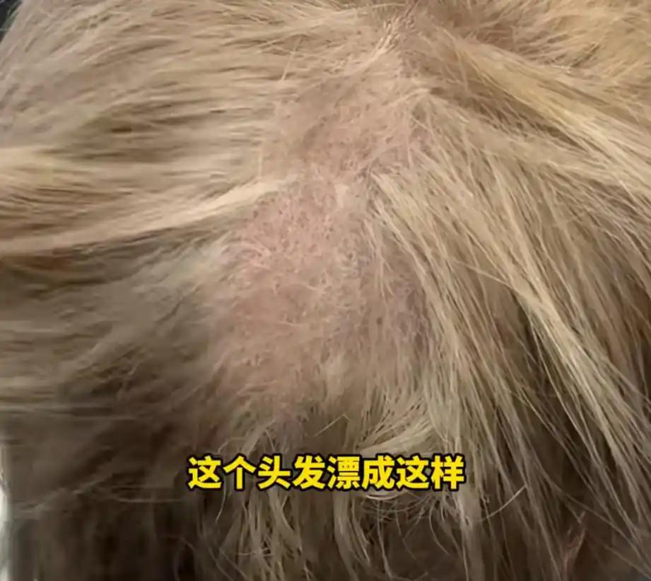 “太吓人了！”近日，上海，一女子去理发店染发，理发师掀开她的头发发现，她里面的头