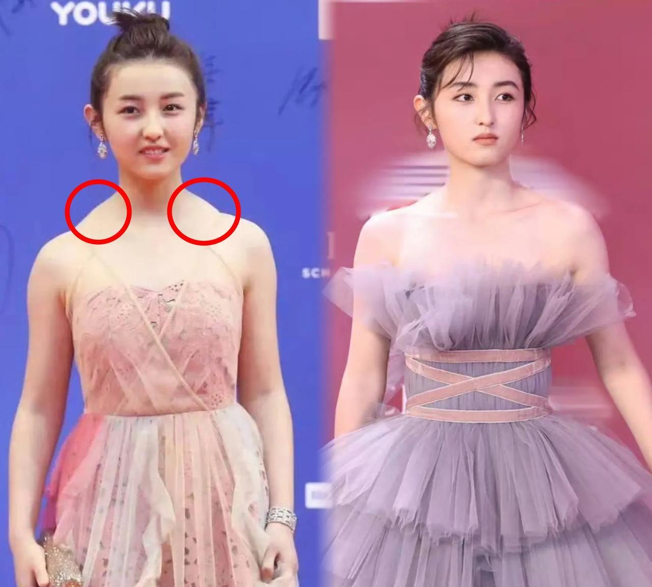 张子枫这小姑娘对自己真够“狠”的！几年前走红毯因为肩膀上的“富贵包”、驼背等仪