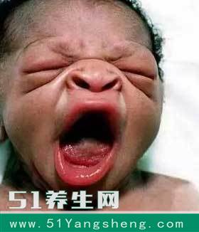 宝宝生下来那么丑, 竟然是妈妈惹的祸