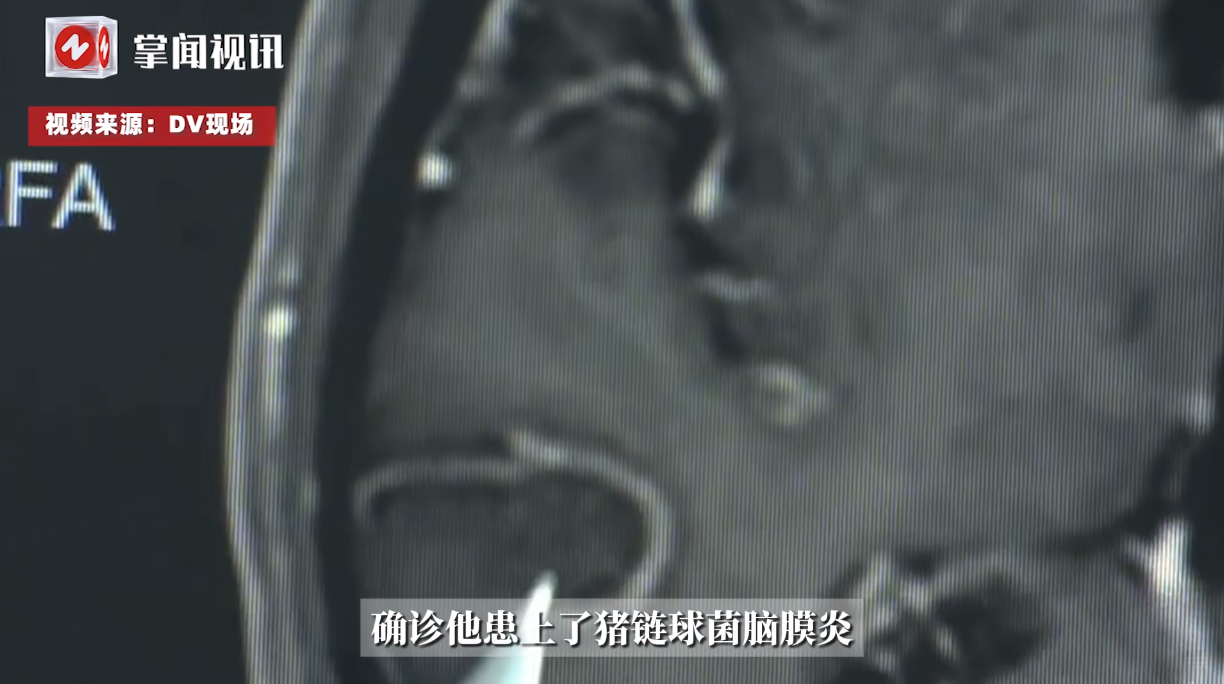 悲剧还是发生了！近日，广东阳江，一72岁的大爷平时养着30多只猪，谁知他却突然开