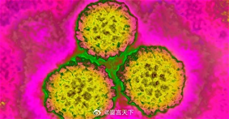 2024年全球约有230万例新发癌症与感染有关2024年全球约有230万例新发