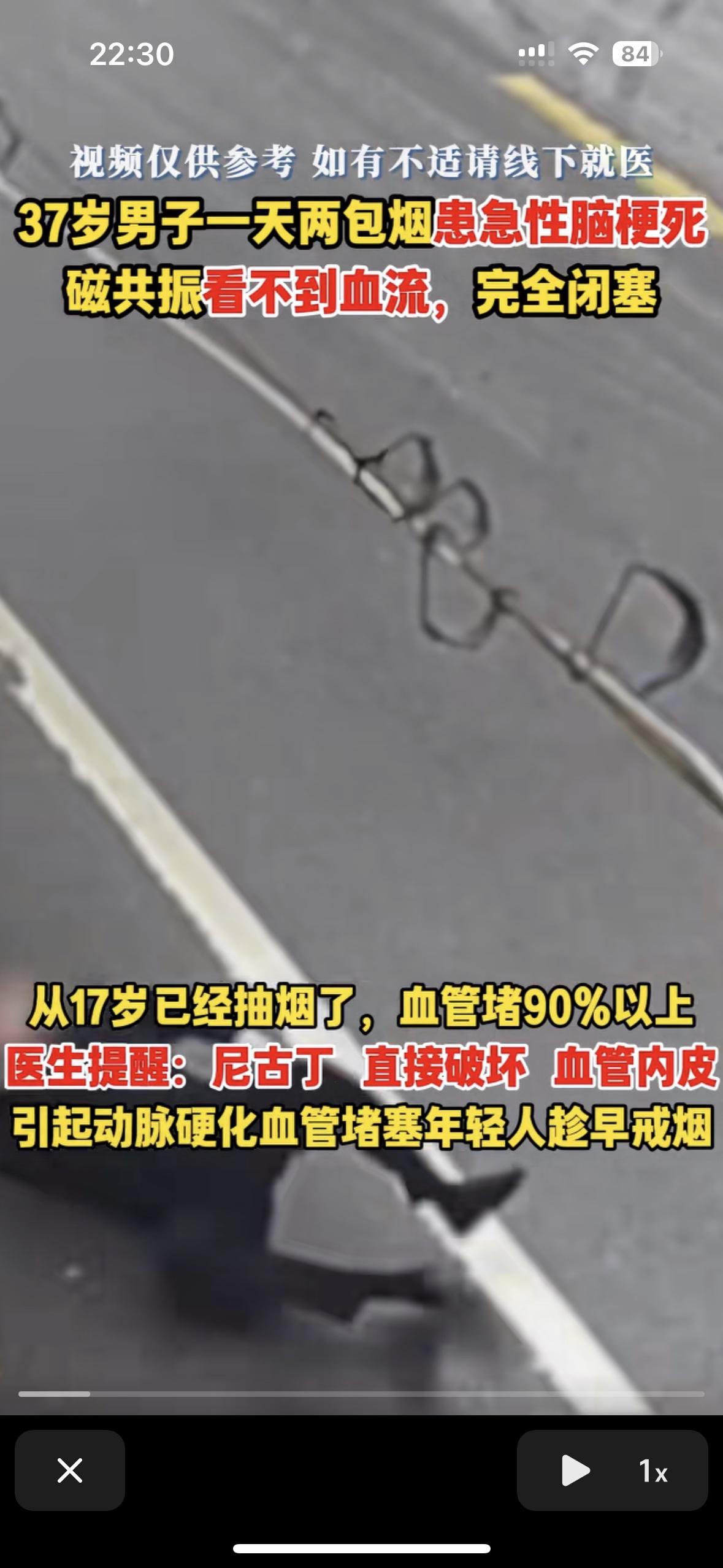 男人总说唯一的爱好也要管，真得了病就不这么说了37岁一男子一天两包烟，突然嘴歪