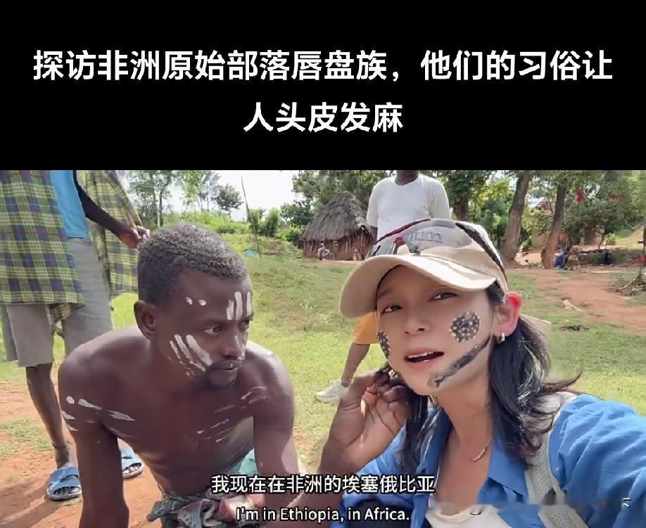 看着就疼，感谢老天让我生在中国！