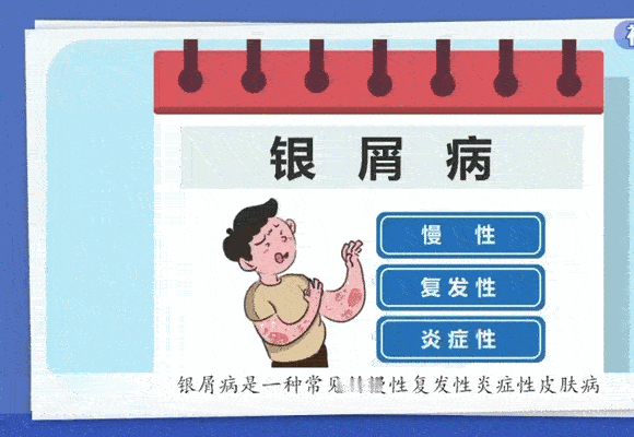 秋冬换季又被银屑病整破防了谁懂啊！一换季又被银屑病整破防了。痒到抓心就算了，露皮