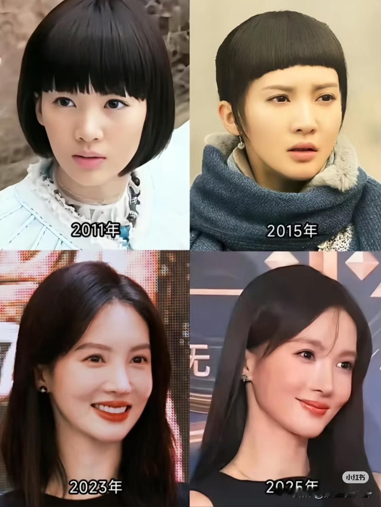 在整容和违法之间金晨选择了整容没想到这次真被网友猜中了，金晨果然是因为撞到假