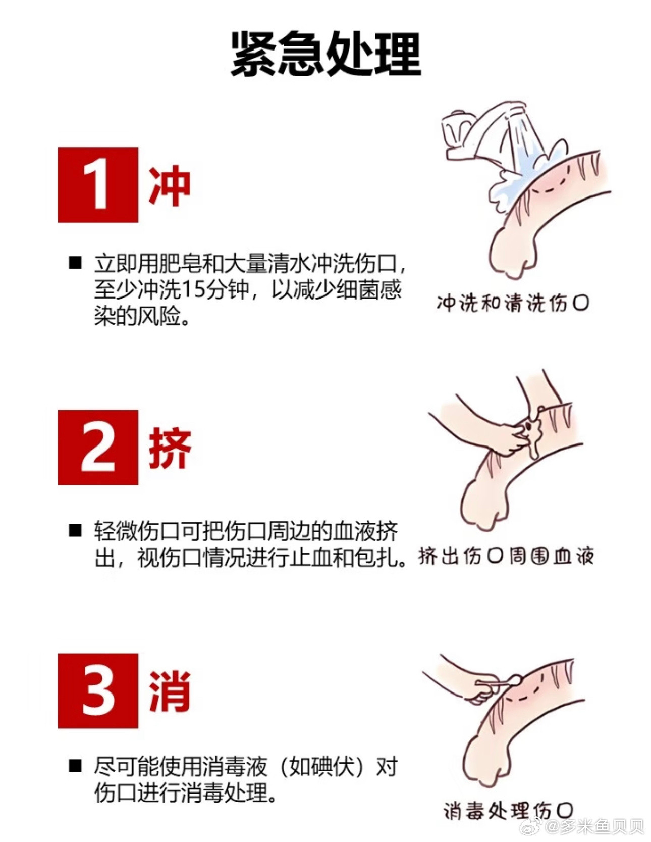 女孩怕责备隐瞒被狗咬后狂犬病去世猫狗兔抓伤咬伤急救一冲二挤三消1.冲：肥皂水+