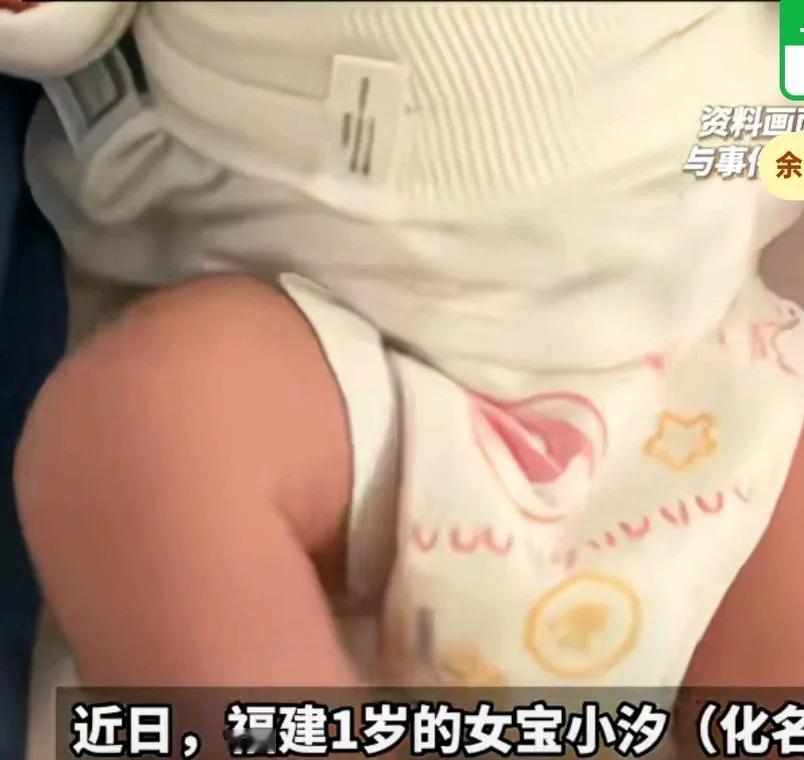 一岁娃娃突然瘫痪,竟然是中了毒,并提醒购买食品一定要看准,福建一岁的女宝父母发现