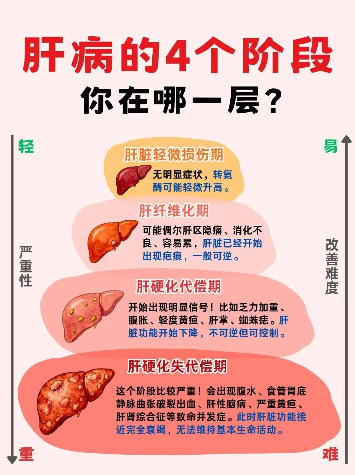 乙肝 肝硬化 腹水 健康科普 肝病教授陈士俊
