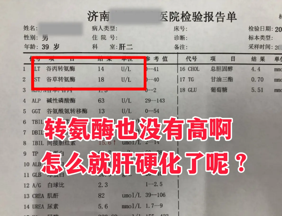 今天门诊来了一位 39岁的患者，拿到报告很困惑，跟我说：教授，我的转氨...