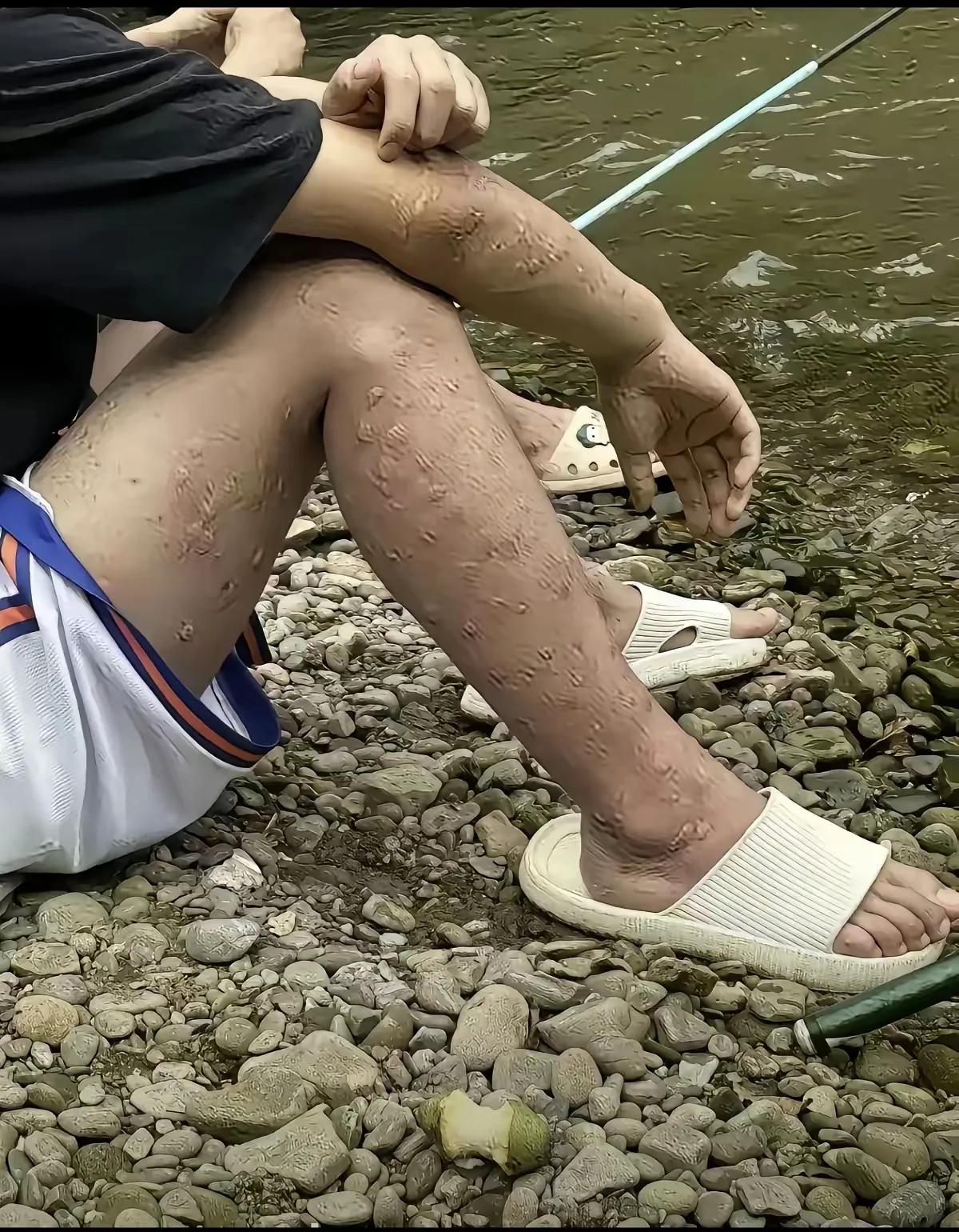 这位哥们真是牛人，腿上胳膊上全是蚊子包，人家浑然不觉，依旧坐在河边钓鱼。我问他