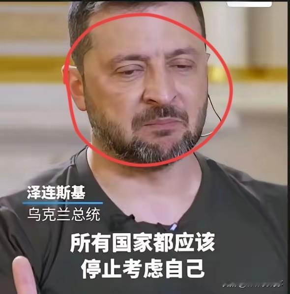 泽连斯基终于后悔了！大家发现没有，现在很少看到泽连斯基外出演讲，访问，都是躲在家