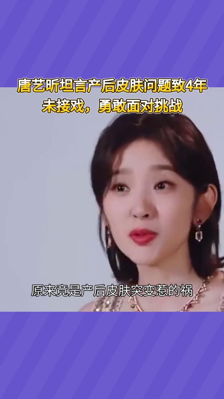 唐艺昕坦言产后皮肤问题致4年未接戏，勇敢面对挑战。唐艺昕为何4年未接戏？原来竟