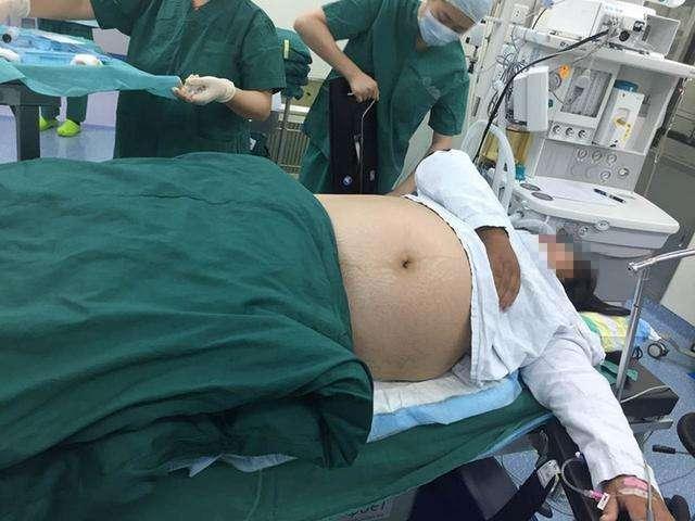 高龄产妇生下来一个有三只“眼睛”的二郎神宝宝, 高龄生产错了?