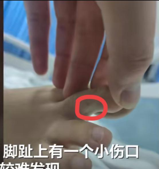三亚27岁游客疑似被蛇咬伤致死，去了医院竟然也没救回一条命，这回三亚的医疗条