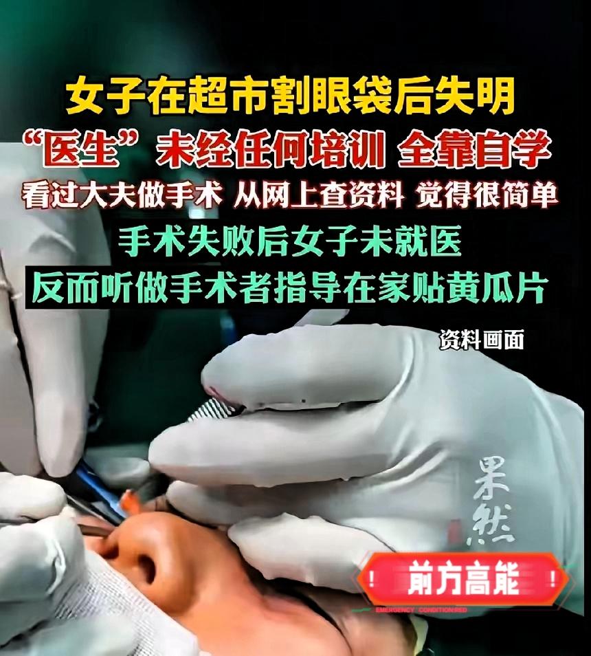 谁能想到？居然有人在超市里割眼袋？我都以为眼花了，结果没想到直接把左眼搞