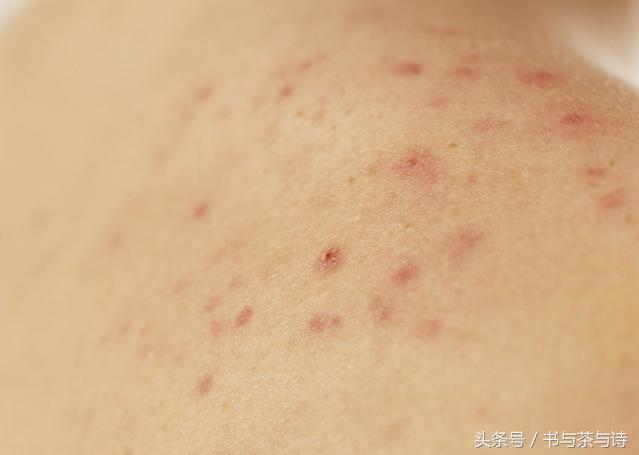 冬天每天白水里面撒3颗, 3天口臭全无, 肠胃好了, 人也精神了!