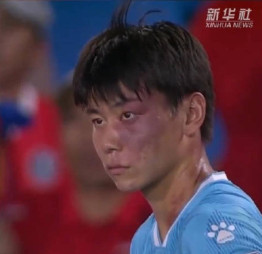 这是世界足球史上都没有过的奇迹，竟然奇迹般地在中国发生了。当没有城市愿意