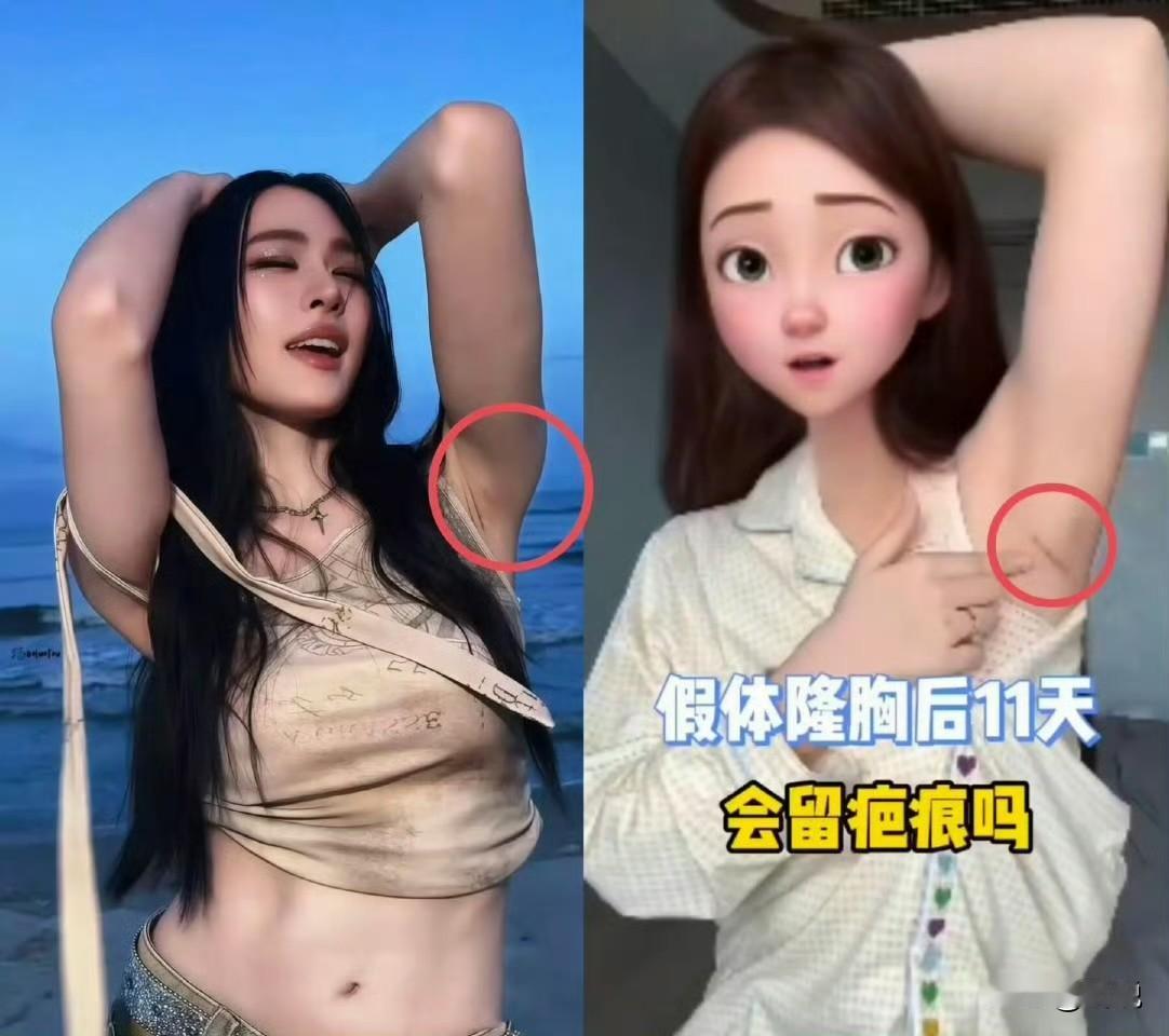 女生为了爱美付出不少啊