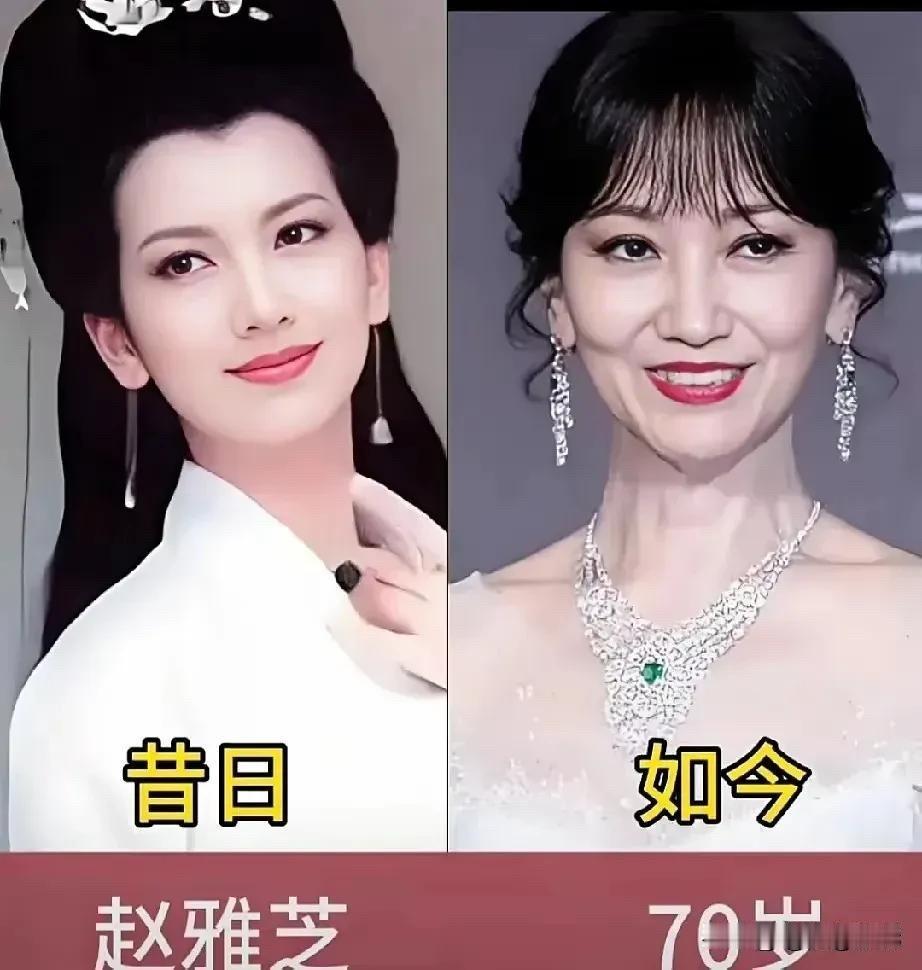 岁月不败美人！赵雅芝、潘虹、宋丹丹、叶童今昔对比，谁才是真正的“冻龄女神”？