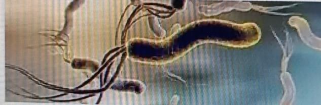 和幽门螺旋杆菌的人一起吃饭，不一定会被传染。它主要通过口口、粪口传播，像共用餐具