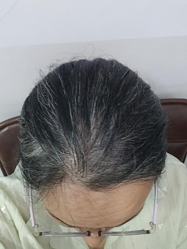 38岁，顶着一头白发去开家长会，我顿悟了！今天扎起头发去开家长会，后排的妈妈轻