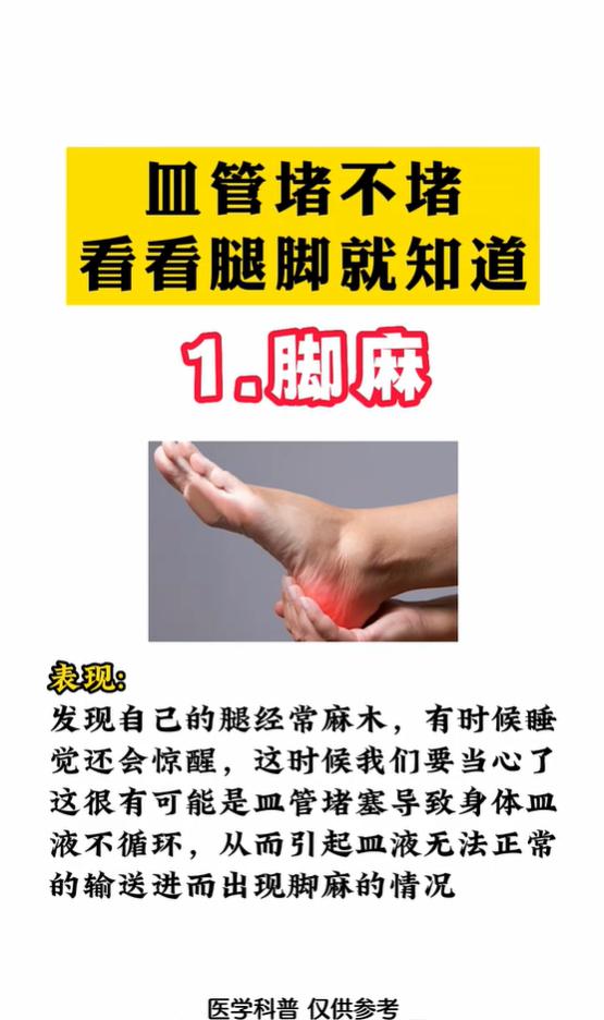 下肢气血瘀滞的6类外在表现，简单自测血管通畅度