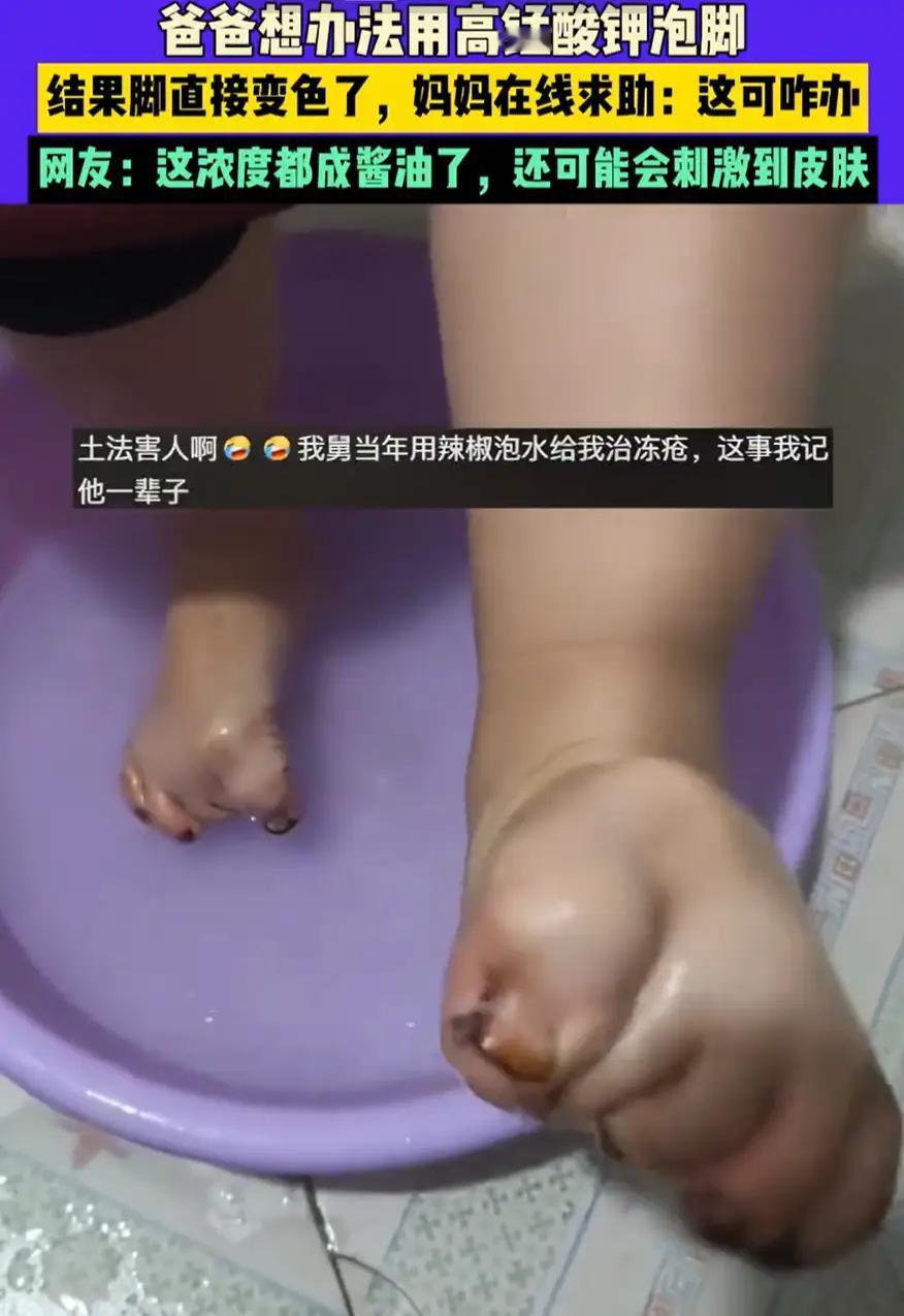 山东，一对夫妻发现孩子的脚蜕皮，爸爸想办法说可以用高锰酸钾泡脚，没想到，这一泡直
