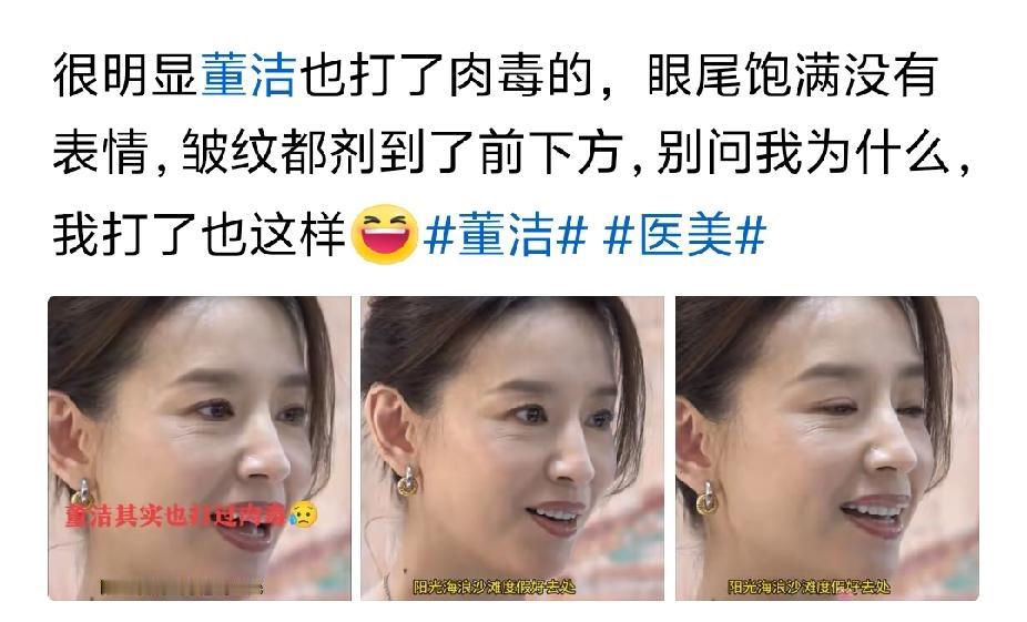 我跟她一样的皱纹长在眼下，眼尾一根皱纹都没有，我脸上什么乱七八糟的东西都没打过