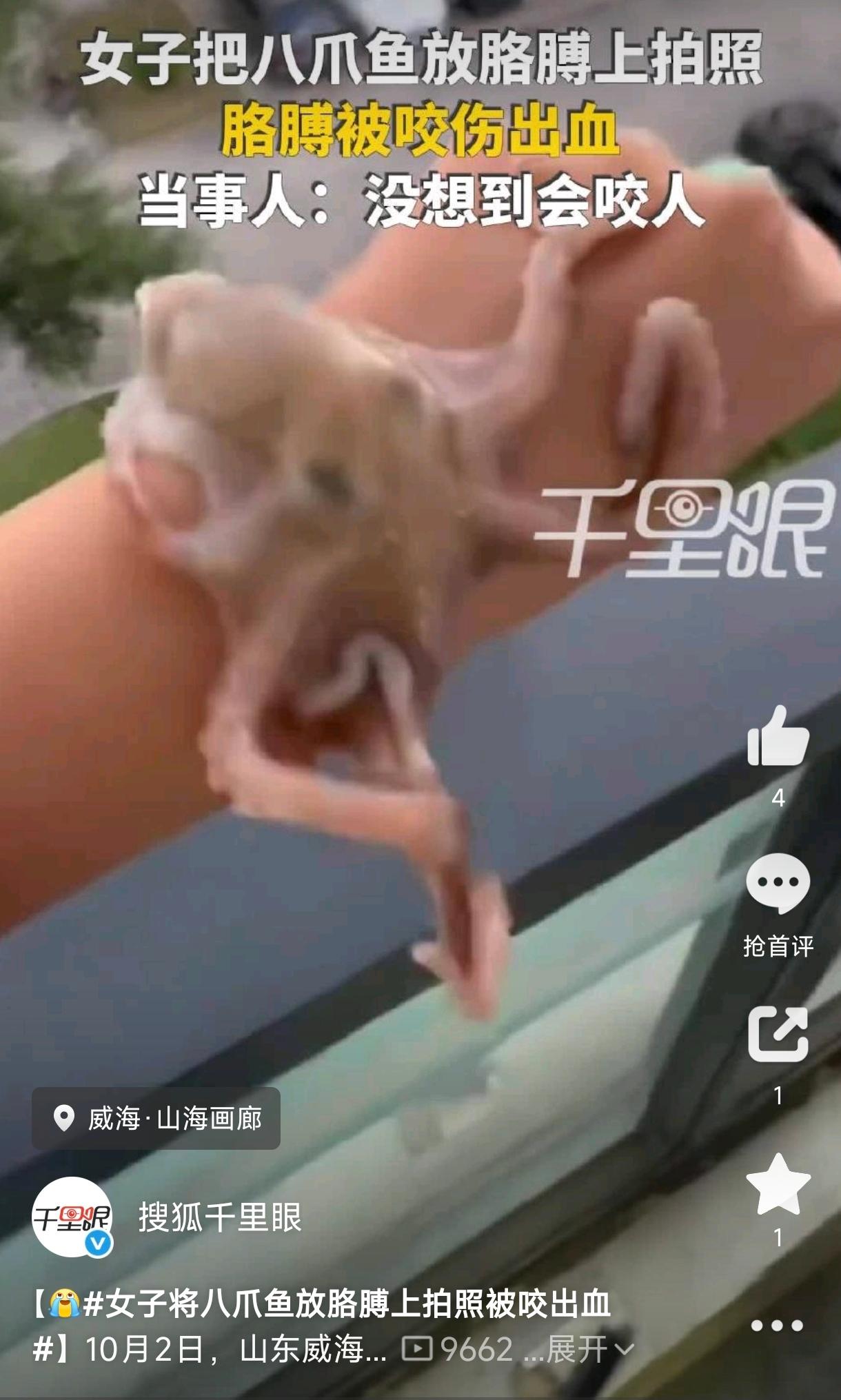 山东威海，一女子把一只活蹦乱跳的八爪鱼放在胳膊上准备拍视频，还没等镜头对准，一阵