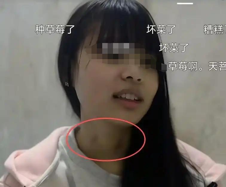 网上一位家长曝出揪心一幕，自家还在上中学的女儿早恋，家长意外发现孩子脖子上有暧昧