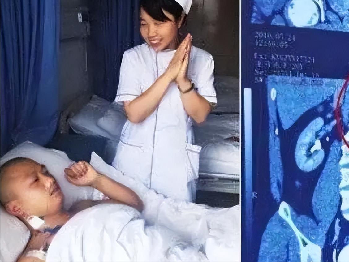 “我的丈夫有4个肾！”2016年，贵州一男子天生神力，可以把白酒当水喝，除此之外