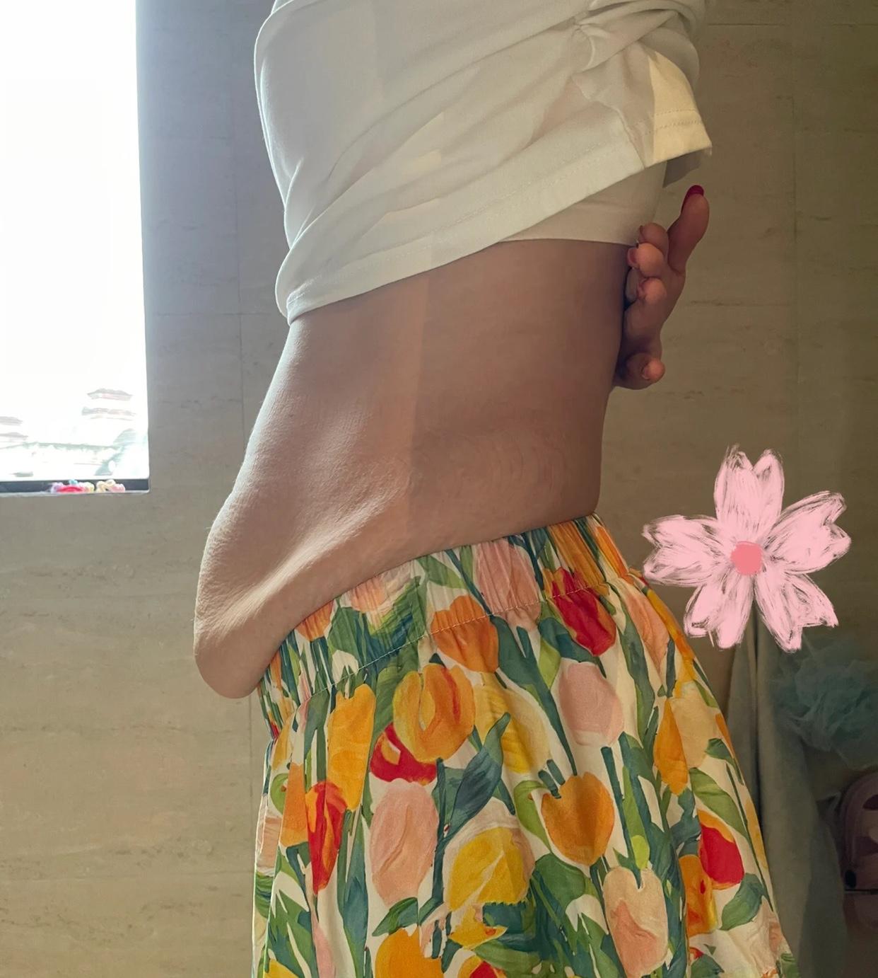 这肚子还能恢复吗？双胞胎落地孩子白白胖胖，婆婆公公和老公都在客厅抱着嘻嘻哈哈