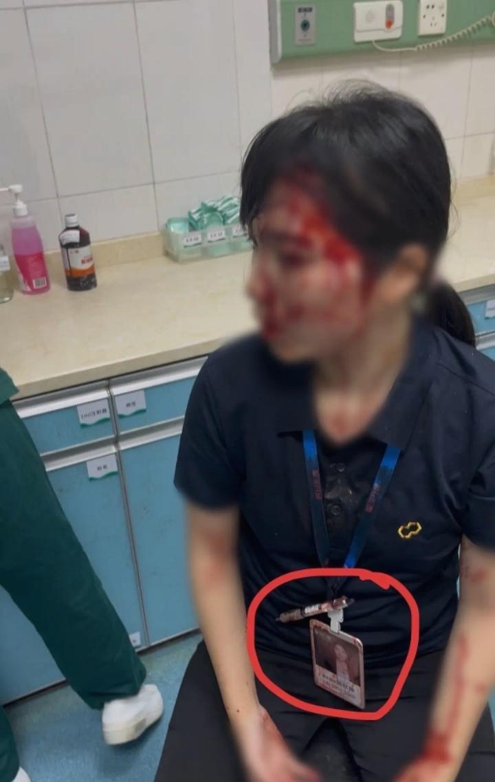 惠州女子被男同事用水杯砸伤后续，被砸女子陈女士称，自己是销售部，男同事是合同部，