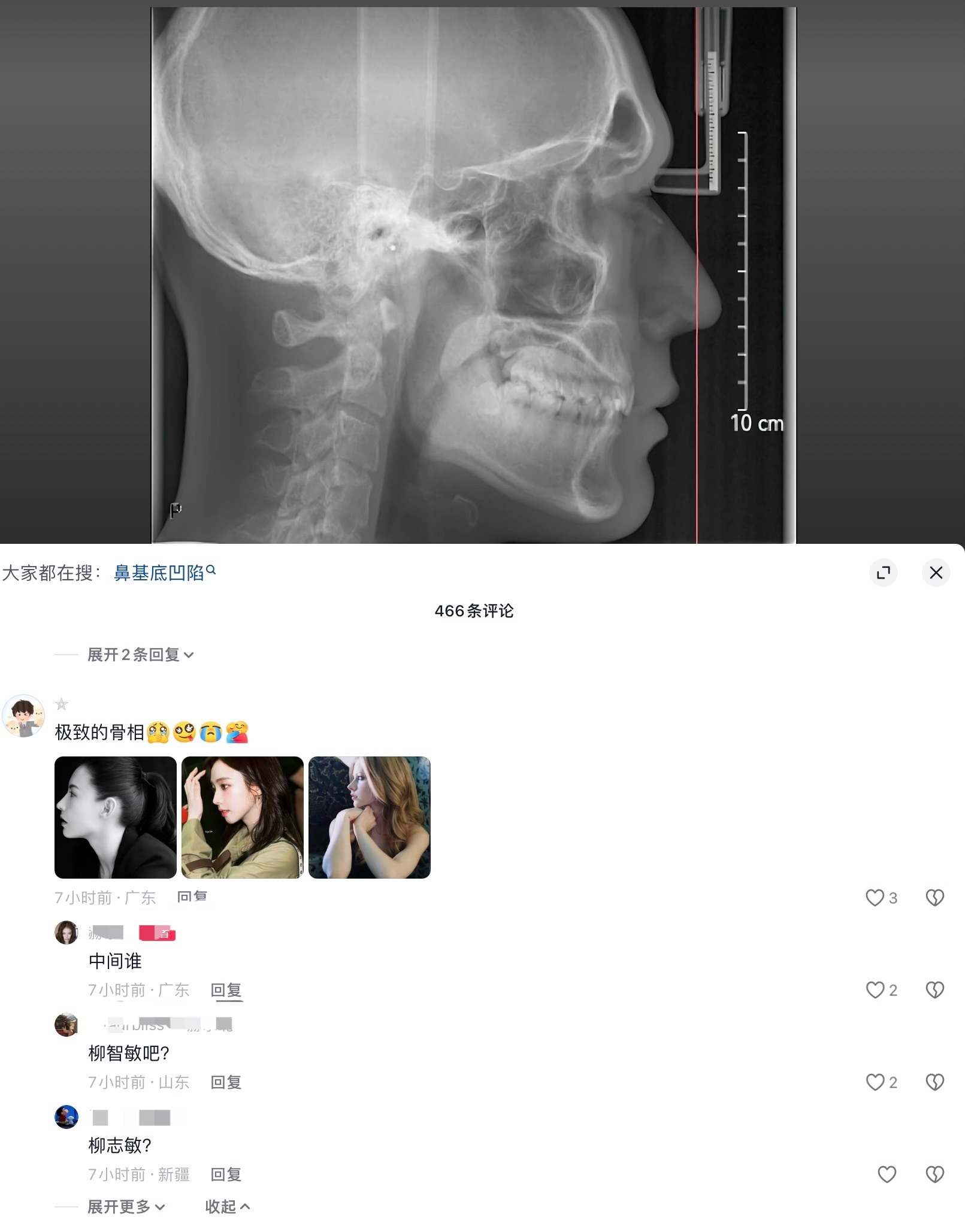 “极致的骨相”柳智敏