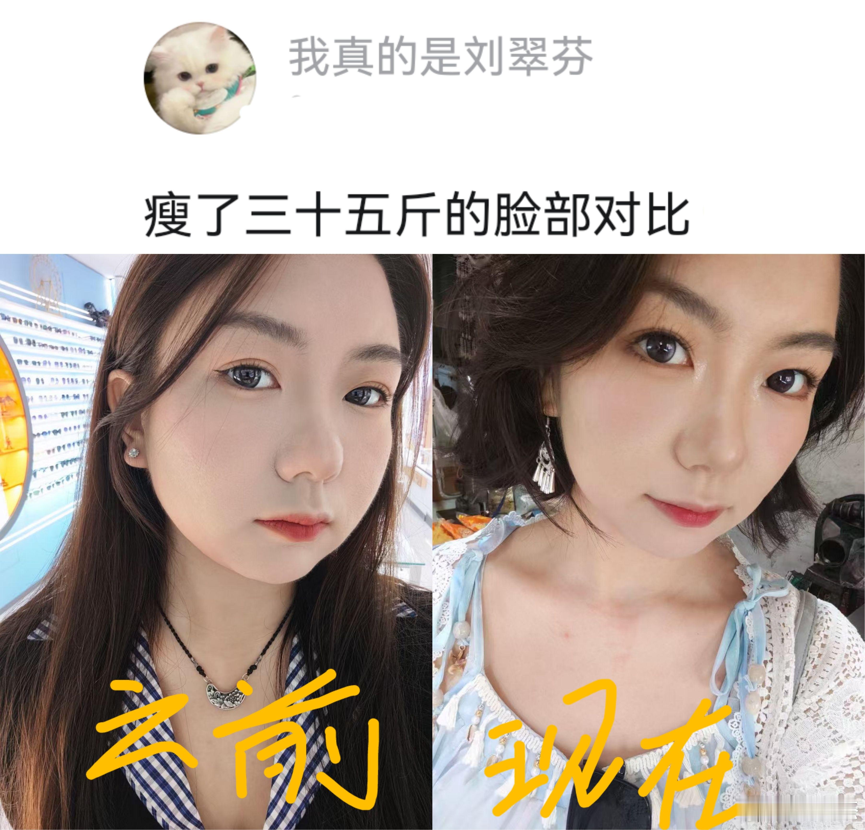 美女瘦了35斤之后的脸部对比，你们觉得变化大吗？​​​
