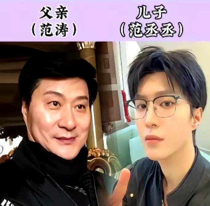 森碟正畸657天，下巴前移4.6毫米婴儿肥退干净，骨相开始说话。2025年